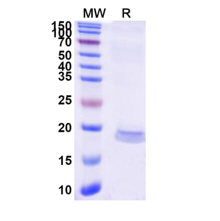 SDS-PAGE - Anti-MCP 1 Nanobody [SAA1269] (A337820) - Antibodies.com