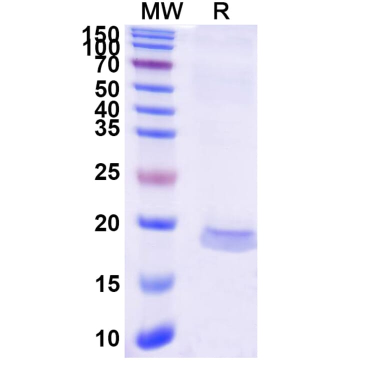 SDS-PAGE - Anti-MCP 1 Nanobody [SAA1269] (A337820) - Antibodies.com