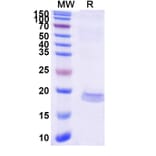 SDS-PAGE - Anti-MCP 1 Nanobody [SAA1269] (A337820) - Antibodies.com