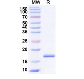 SDS-PAGE - Anti-RANTES Nanobody [SAA1271] (A337821) - Antibodies.com