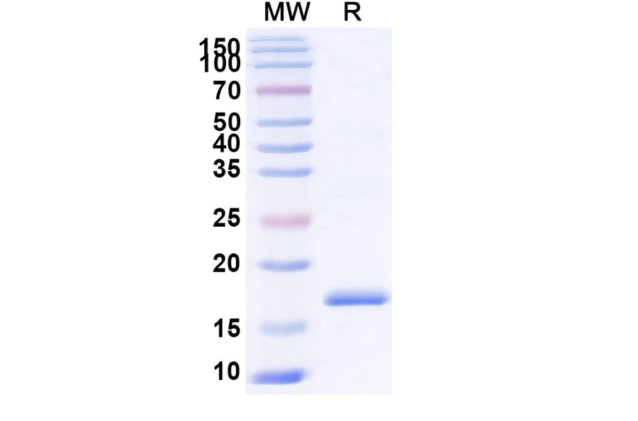 SDS-PAGE - Anti-RANTES Nanobody [SAA1271] (A337821) - Antibodies.com