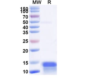 SDS-PAGE - Anti-CFTR Nanobody [SAA1012] (A337823) - Antibodies.com