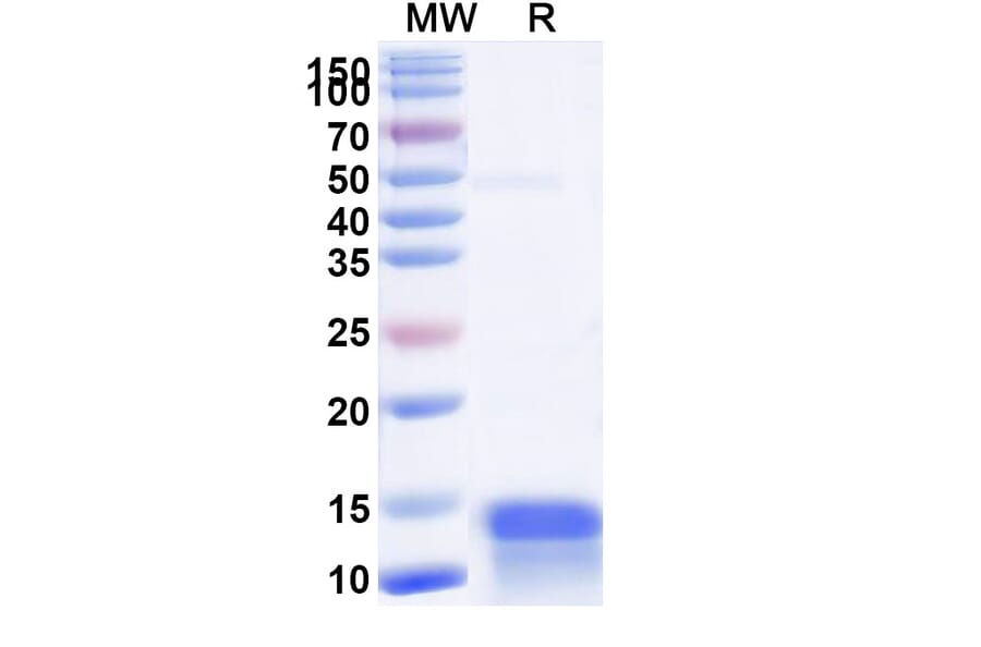 SDS-PAGE - Anti-CFTR Nanobody [SAA1012] (A337823) - Antibodies.com