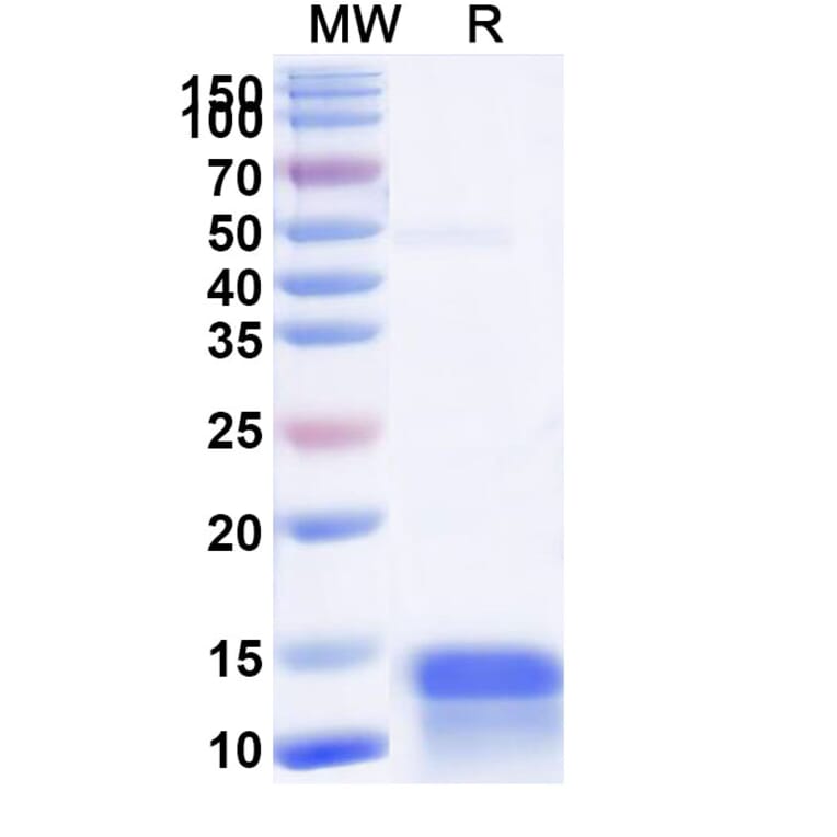 SDS-PAGE - Anti-CFTR Nanobody [SAA1012] (A337823) - Antibodies.com