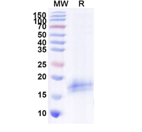 SDS-PAGE - Anti-CFTR Nanobody [SAA1020] (A337825) - Antibodies.com