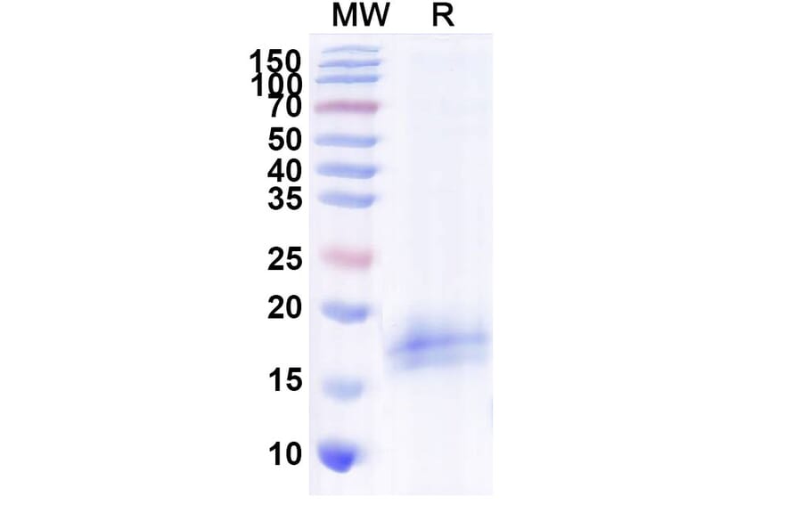 SDS-PAGE - Anti-CFTR Nanobody [SAA1020] (A337825) - Antibodies.com