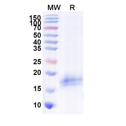 SDS-PAGE - Anti-CFTR Nanobody [SAA1020] (A337825) - Antibodies.com