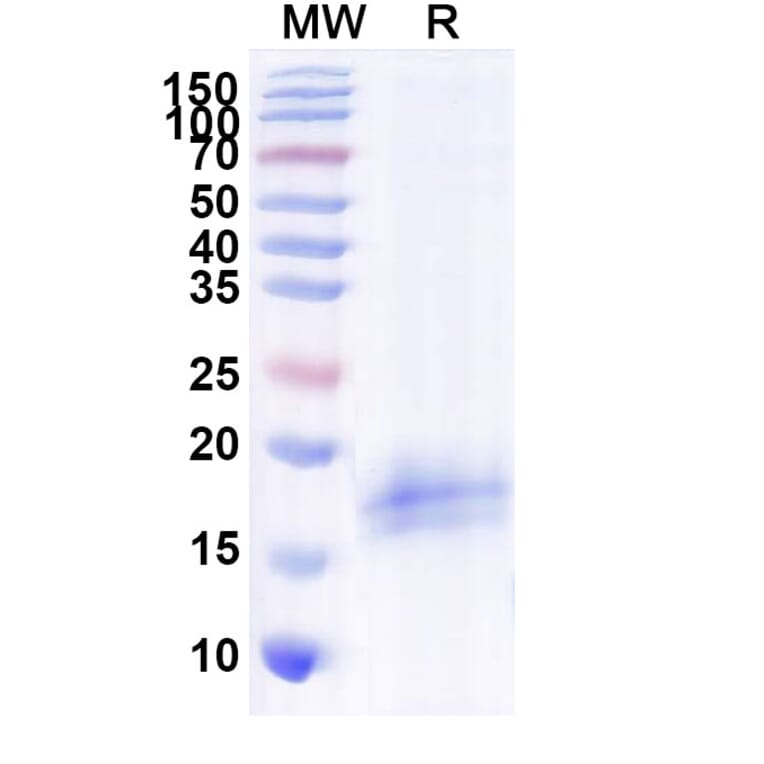 SDS-PAGE - Anti-CFTR Nanobody [SAA1020] (A337825) - Antibodies.com