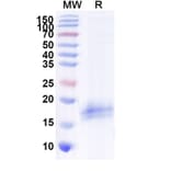 SDS-PAGE - Anti-CFTR Nanobody [SAA1020] (A337825) - Antibodies.com