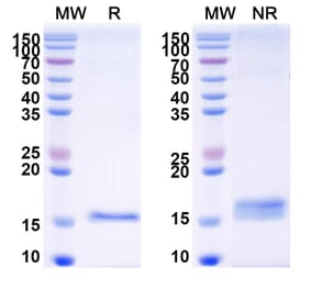 SDS-PAGE - Anti-CFTR Nanobody [SAA1024] (A337826) - Antibodies.com