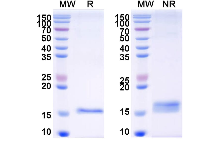 SDS-PAGE - Anti-CFTR Nanobody [SAA1024] (A337826) - Antibodies.com