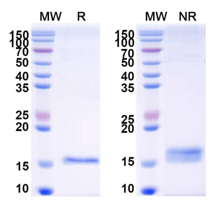 SDS-PAGE - Anti-CFTR Nanobody [SAA1024] (A337826) - Antibodies.com