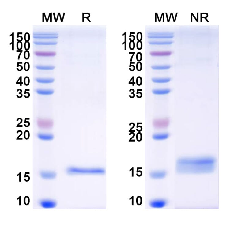 SDS-PAGE - Anti-CFTR Nanobody [SAA1024] (A337826) - Antibodies.com
