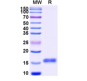 SDS-PAGE - Anti-CFTR Nanobody [SAA1042] (A337827) - Antibodies.com
