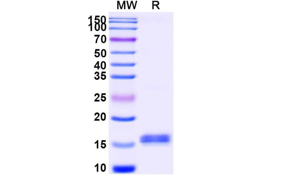 SDS-PAGE - Anti-CFTR Nanobody [SAA1042] (A337827) - Antibodies.com