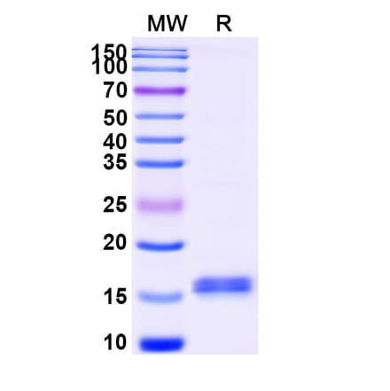 SDS-PAGE - Anti-CFTR Nanobody [SAA1042] (A337827) - Antibodies.com