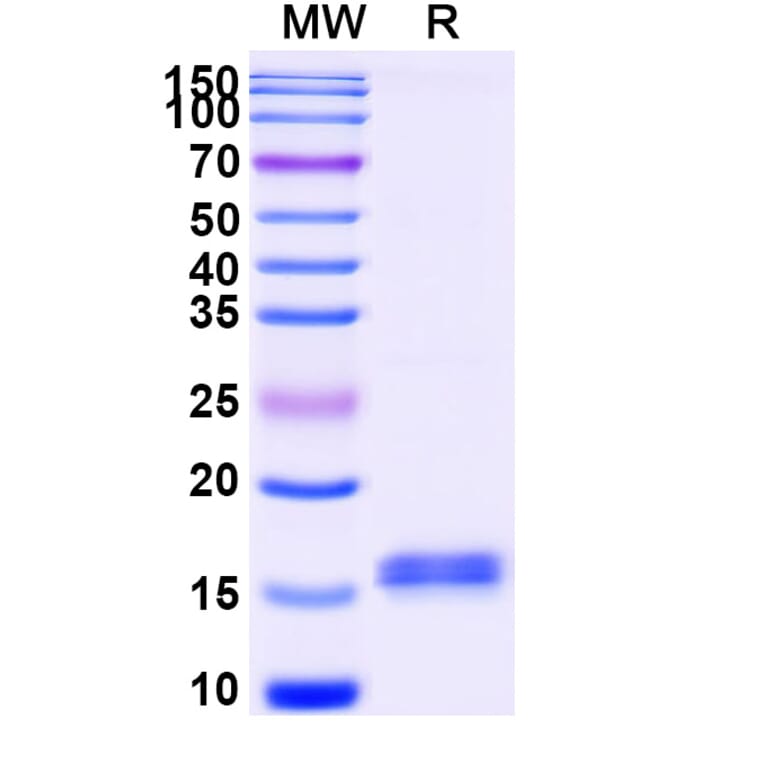 SDS-PAGE - Anti-CFTR Nanobody [SAA1042] (A337827) - Antibodies.com