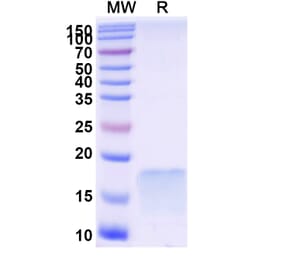 SDS-PAGE - Anti-C6 Nanobody [SAA1039] (A337828) - Antibodies.com