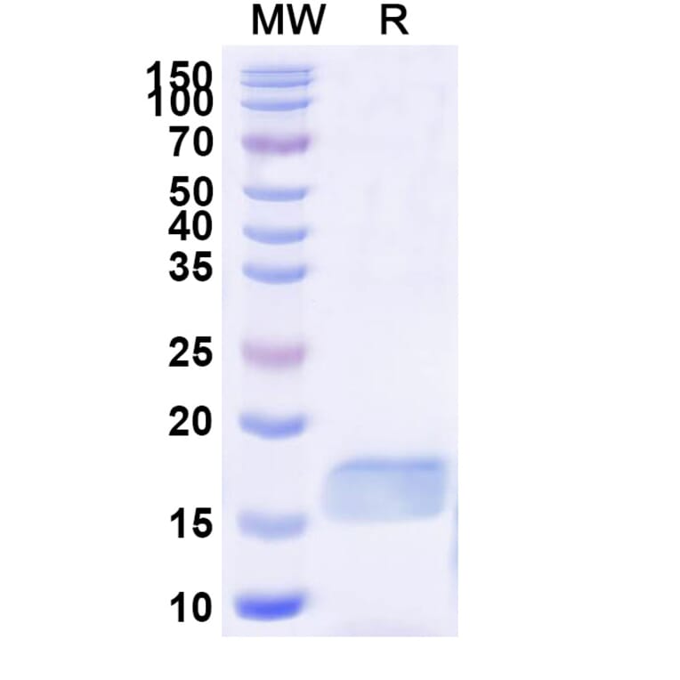 SDS-PAGE - Anti-SGLT1 Nanobody [SAA0963] (A337829) - Antibodies.com