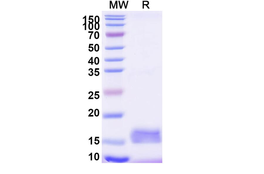 SDS-PAGE - Anti-GABRA1 Nanobody [SAA1342] (A337833) - Antibodies.com