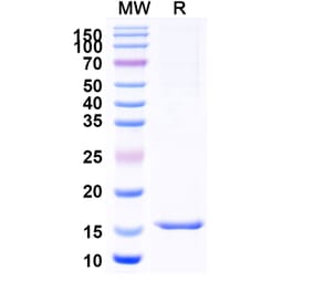 SDS-PAGE - Anti-CD13 Nanobody [SAA1324] (A337834) - Antibodies.com