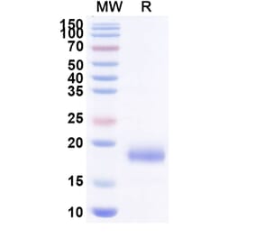 SDS-PAGE - Anti-EPOR Nanobody [SAA0954] (A337845) - Antibodies.com