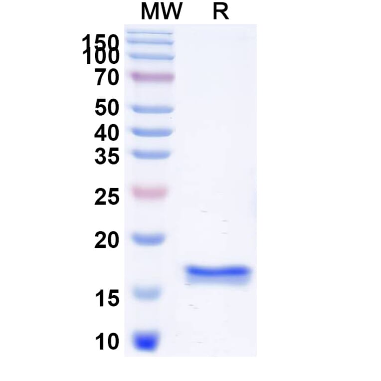SDS-PAGE - Anti-Nucleolin Nanobody [SAA1204] (A337846) - Antibodies.com