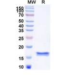 SDS-PAGE - Anti-Nucleolin Nanobody [SAA1204] (A337846) - Antibodies.com