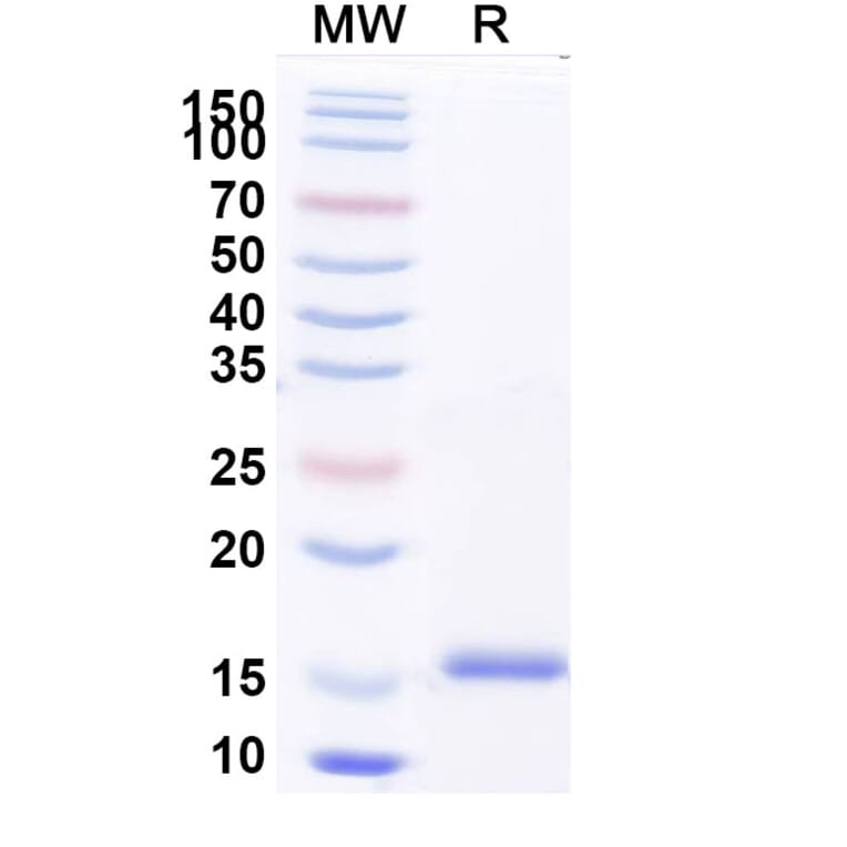 SDS-PAGE - Anti-Kappa Light Chain Nanobody [SAA1354] (A337848) - Antibodies.com