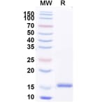 SDS-PAGE - Anti-Kappa Light Chain Nanobody [SAA1354] (A337848) - Antibodies.com