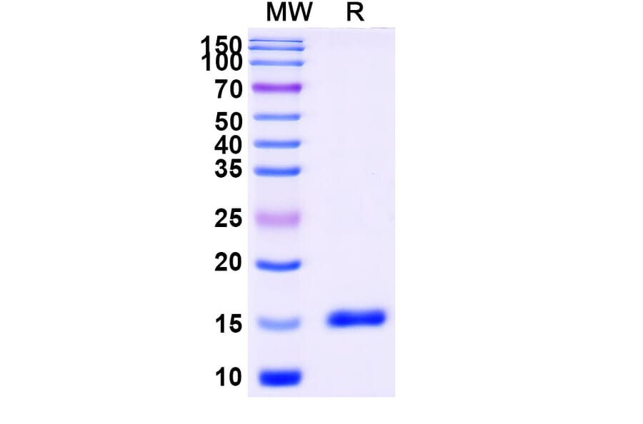 SDS-PAGE - Anti-CD11a Nanobody [SAA1305] (A337849) - Antibodies.com