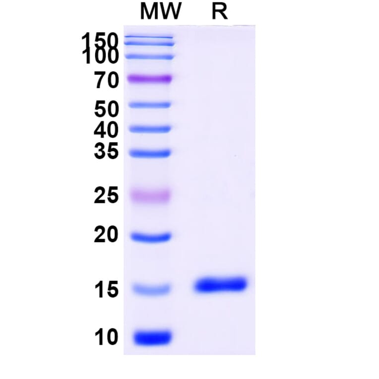 SDS-PAGE - Anti-CD11a Nanobody [SAA1305] (A337849) - Antibodies.com