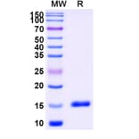SDS-PAGE - Anti-CD11a Nanobody [SAA1305] (A337849) - Antibodies.com