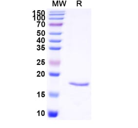 SDS-PAGE - Anti-Cannabinoid Receptor I Nanobody [SAA1274] (A337850) - Antibodies.com