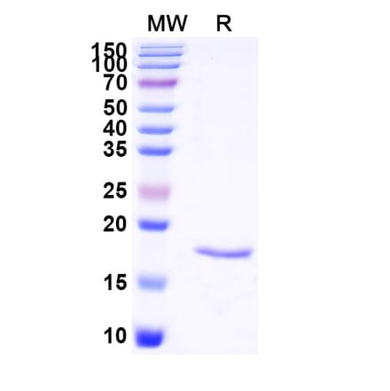 SDS-PAGE - Anti-Cannabinoid Receptor I Nanobody [SAA1274] (A337850) - Antibodies.com