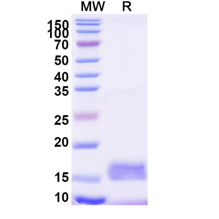 SDS-PAGE - Anti-CD9 Nanobody [SAA0905] (A337852) - Antibodies.com
