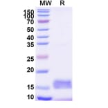 SDS-PAGE - Anti-CD9 Nanobody [SAA0905] (A337852) - Antibodies.com