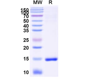SDS-PAGE - Anti-CD9 Nanobody [SAA0917] (A337853) - Antibodies.com