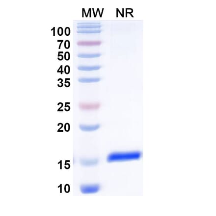 SDS-PAGE - Anti-KCNA3 Nanobody [SAA0971] (A337854) - Antibodies.com