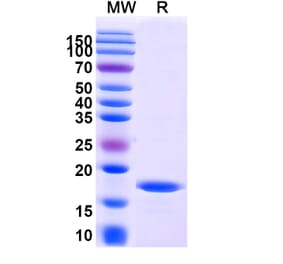 SDS-PAGE - Anti-OX40L Nanobody [SAA1277] (A337855) - Antibodies.com