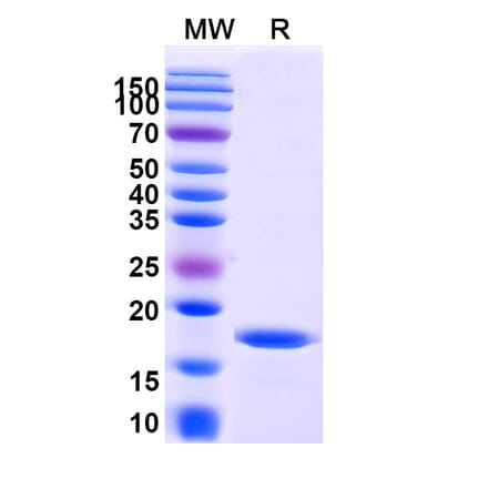 SDS-PAGE - Anti-OX40L Nanobody [SAA1277] (A337855) - Antibodies.com