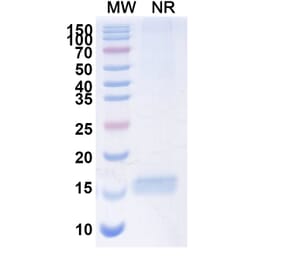 SDS-PAGE - Anti-HRH2 Nanobody [SAA0994] (A337856) - Antibodies.com