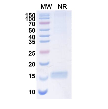 SDS-PAGE - Anti-HRH2 Nanobody [SAA0994] (A337856) - Antibodies.com
