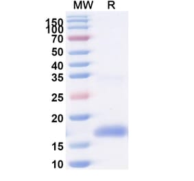 SDS-PAGE - Anti-CXCR2 Nanobody [SAA1360] (A337857) - Antibodies.com