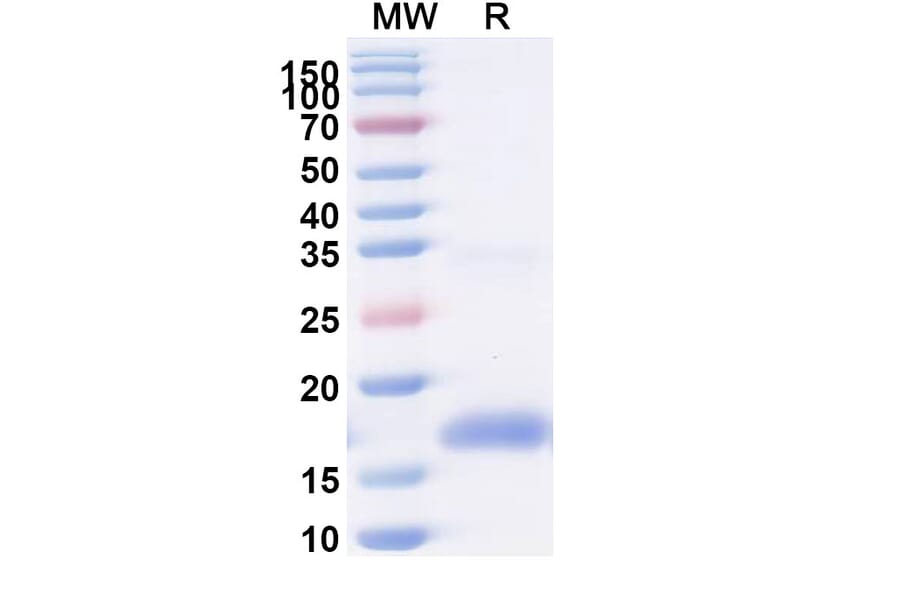SDS-PAGE - Anti-CXCR2 Nanobody [SAA1360] (A337857) - Antibodies.com