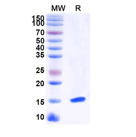 SDS-PAGE - Anti-LMO2 Nanobody [SAA1172] (A337858) - Antibodies.com
