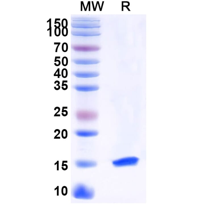 SDS-PAGE - Anti-LMO2 Nanobody [SAA1172] (A337858) - Antibodies.com