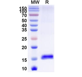 SDS-PAGE - Anti-LMO2 Nanobody [SAA0919] (A337859) - Antibodies.com