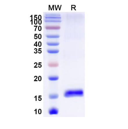 SDS-PAGE - Anti-LMO2 Nanobody [SAA0919] (A337859) - Antibodies.com