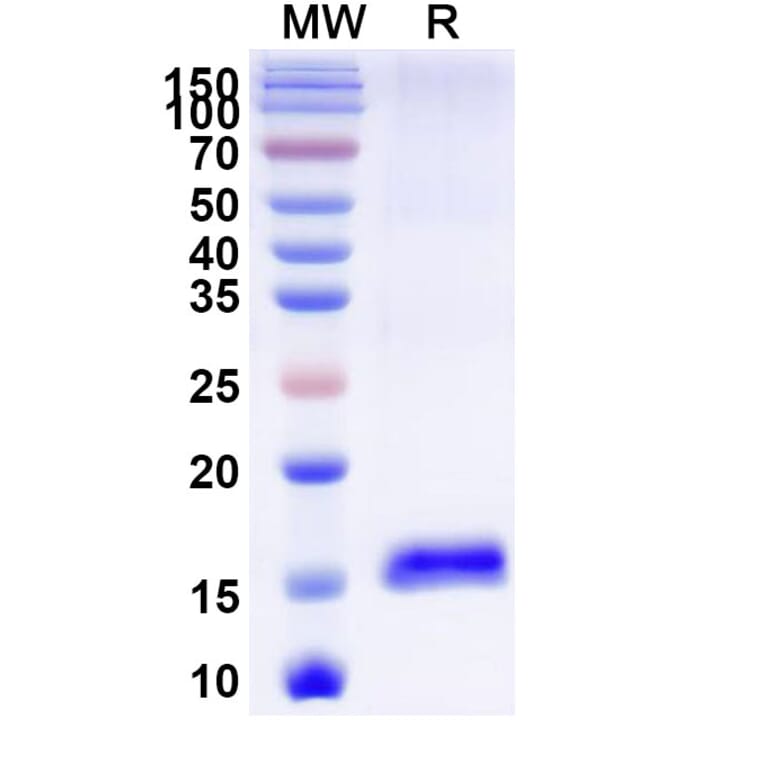 SDS-PAGE - Anti-LMO2 Nanobody [SAA0919] (A337859) - Antibodies.com